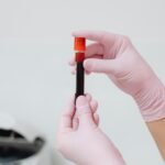 hs-CRP blood test analysis